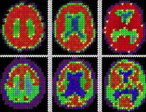 neuroimaging of brain scans depicted as puzzle pieces